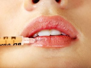 Fotolia 46551525 XS 300x225 - ¡Quiero unos labios turgentes!