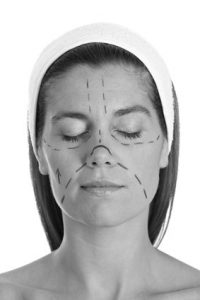 Fotolia 41684186 XS 200x300 - Lifting facial para las arrugas