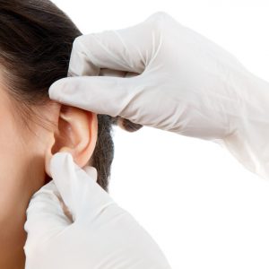 Lóbulo de la oreja 300x300 - Cirugía Estética del Lóbulo Auricular