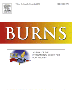 tapa burns - Nuevo artículo publicado en la revista Burns