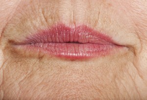 Arrugas labios código de barras 300x204 - ¿Cómo puedo tener unos labios bonitos?