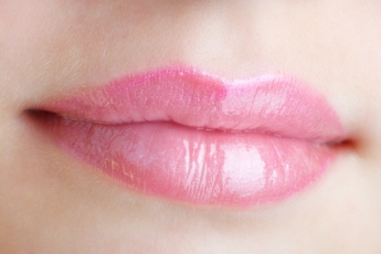Lifting de labios - El Lifting de labios, última tendencia en rejuvenecimiento facial