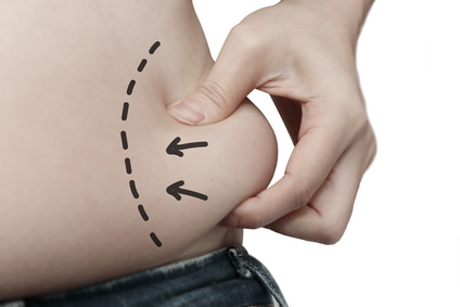 Liposucción masculina - Liposucción abdominal masculina: principales técnicas y recomendaciones médicas.