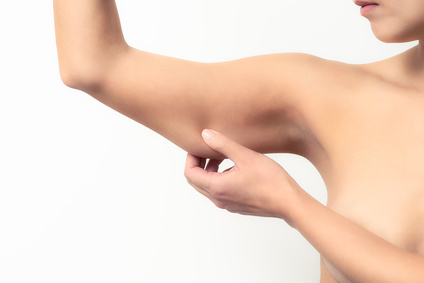 Celulitis brazos barcelona - ¿Qué es la braquioplastia o lifting de brazos?