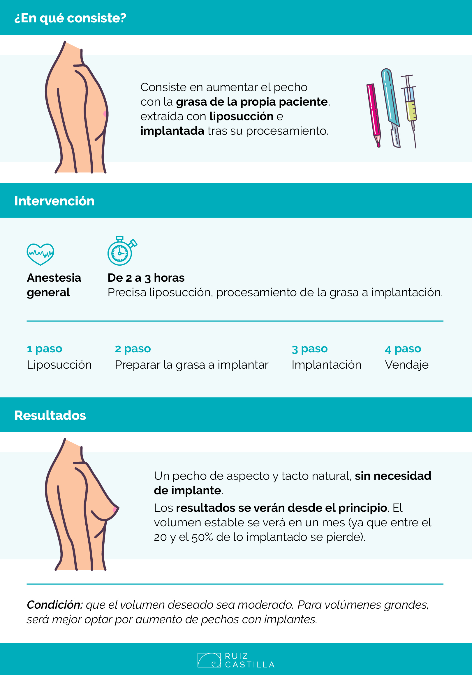 AUMENTO DE PECHO INFOGRAFIA RC 2 - El aumento de pecho con grasa propia