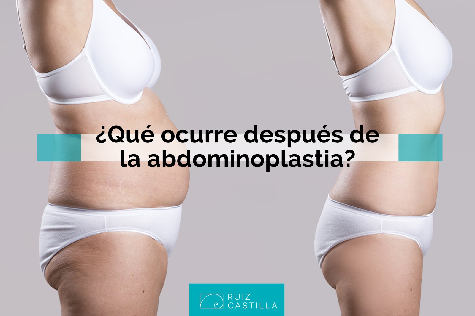 Abdominoplastia: postoperatorio y recuperación cirugía de abdomen